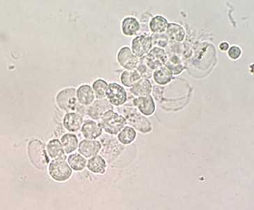 Case Image