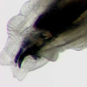 Case397_B