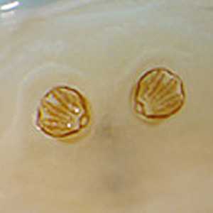 Case397_D