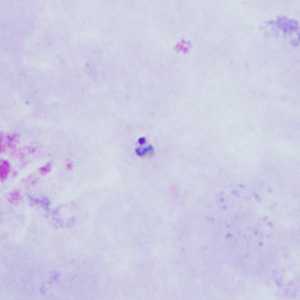 Case Image