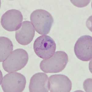 Case398_C