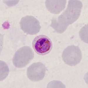Case398_I