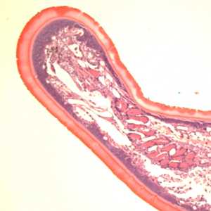 Case399_E