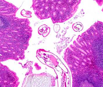 Case Image