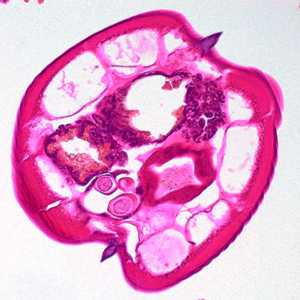 Case400_D