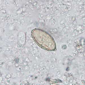 Case Image