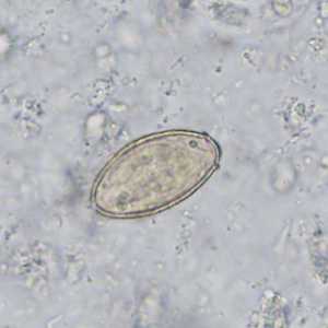 Case402_B