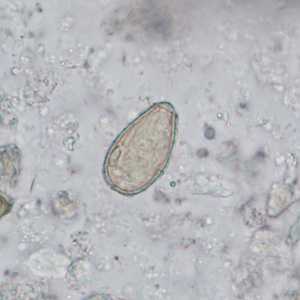 Case402_C