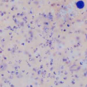 Case403_B