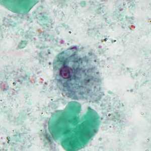 Case Image