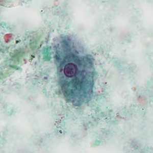 Case404_C