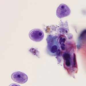 Case Image
