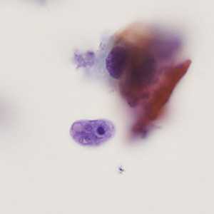 Case405_C