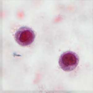 Case406_B