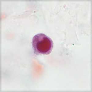 Case406_D