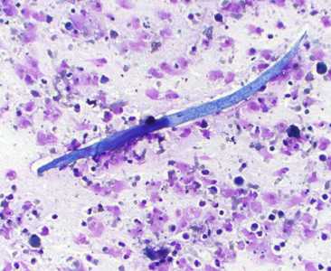 Case Image