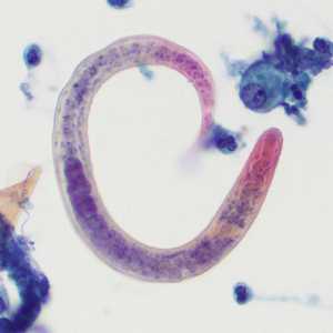 Case407_C