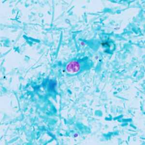 Case Image