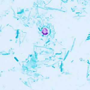 Case409_E