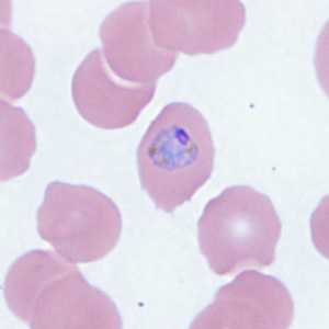 Case Image