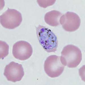 Case410_G