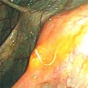 Case Image