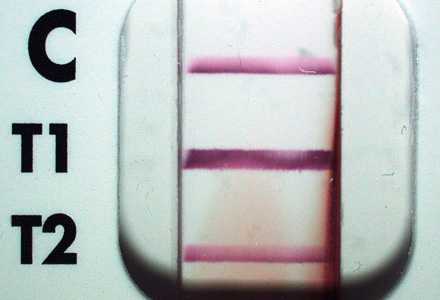 Case Image