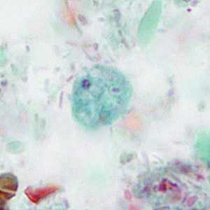 Case Image