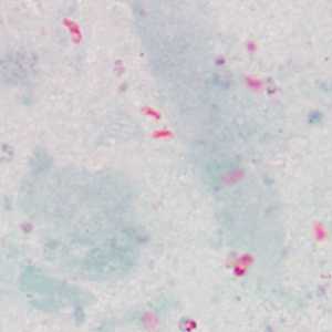 Figure D