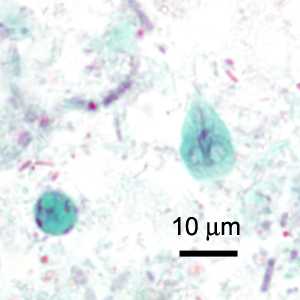 Figure B