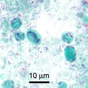 Figure C