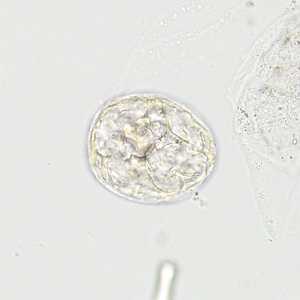 Case Image