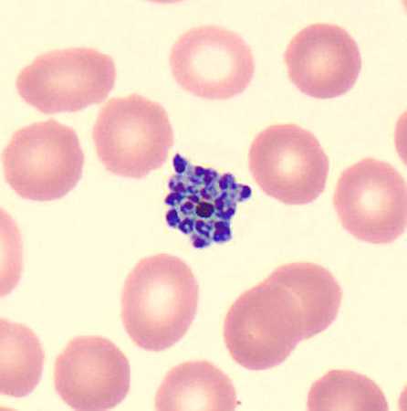 Figure B