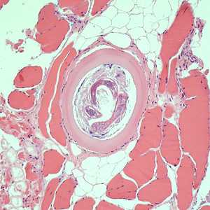 Figure C
