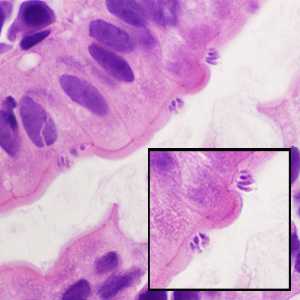 Figure D