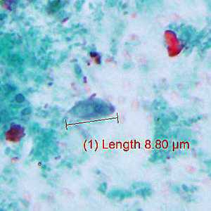 parasitic image