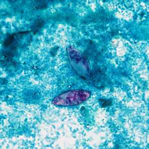 case image