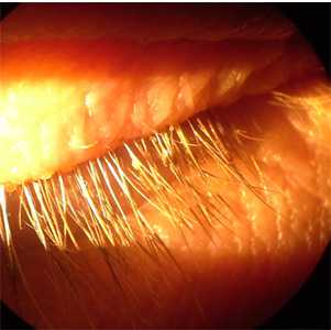 parasitic image
