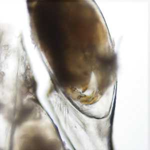 parasitic image