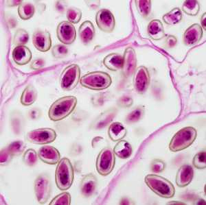 parasitic images