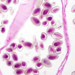 parasitic images