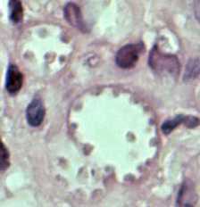 Figure B