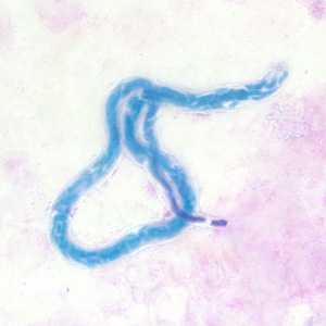 Figure C