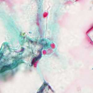 Figure C
