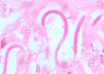 Figure C