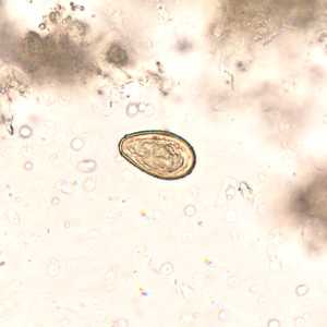 Figure B