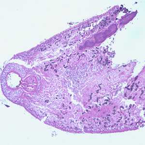 Figure C