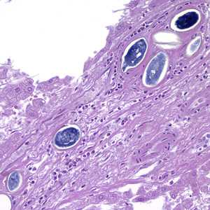 Figure C