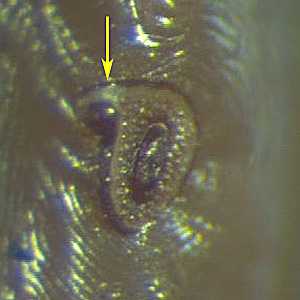 Figure F