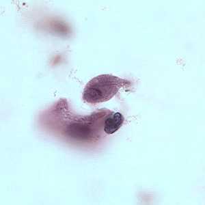 Figure B